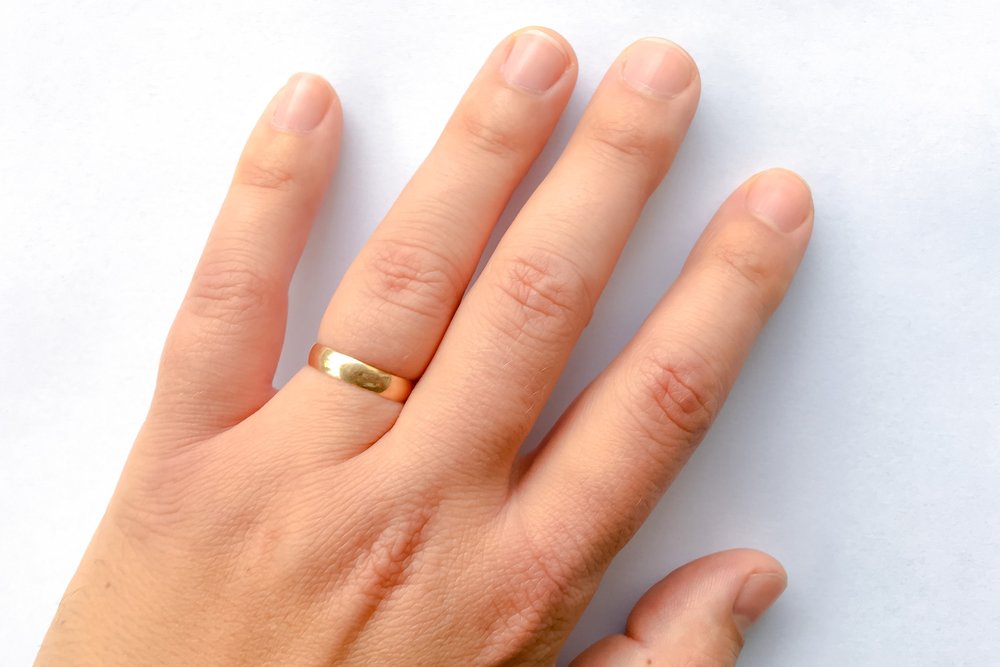 6 Easy Hacks Guide: How to Get Stuck Ring Off a Swollen Finger?